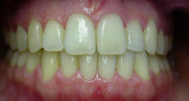 Foto del sorriso del paziente dopo la cura