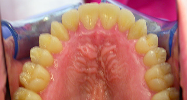 Foto del sorriso del paziente dopo la cura