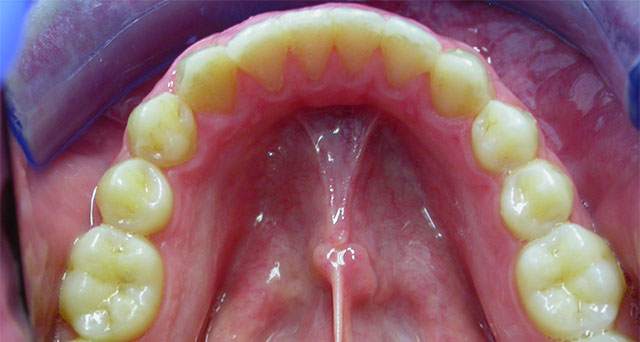 Foto del sorriso del paziente dopo la cura