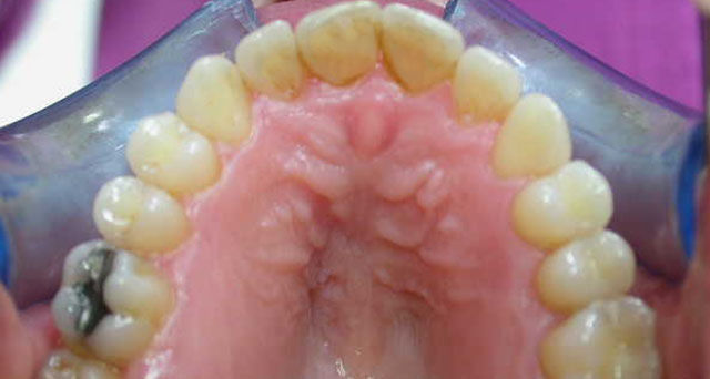 Foto del sorriso del paziente dopo la cura