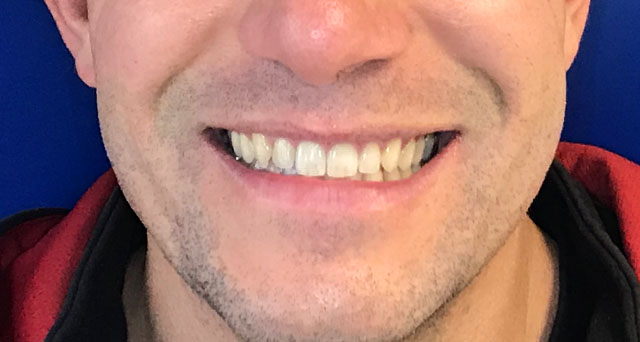Dopo