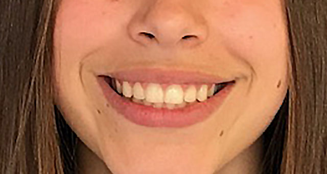 Foto del sorriso del paziente dopo la cura